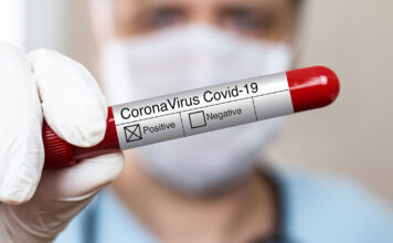 Preocupante: 99 casos activos de Covid-19 en A. Alsina